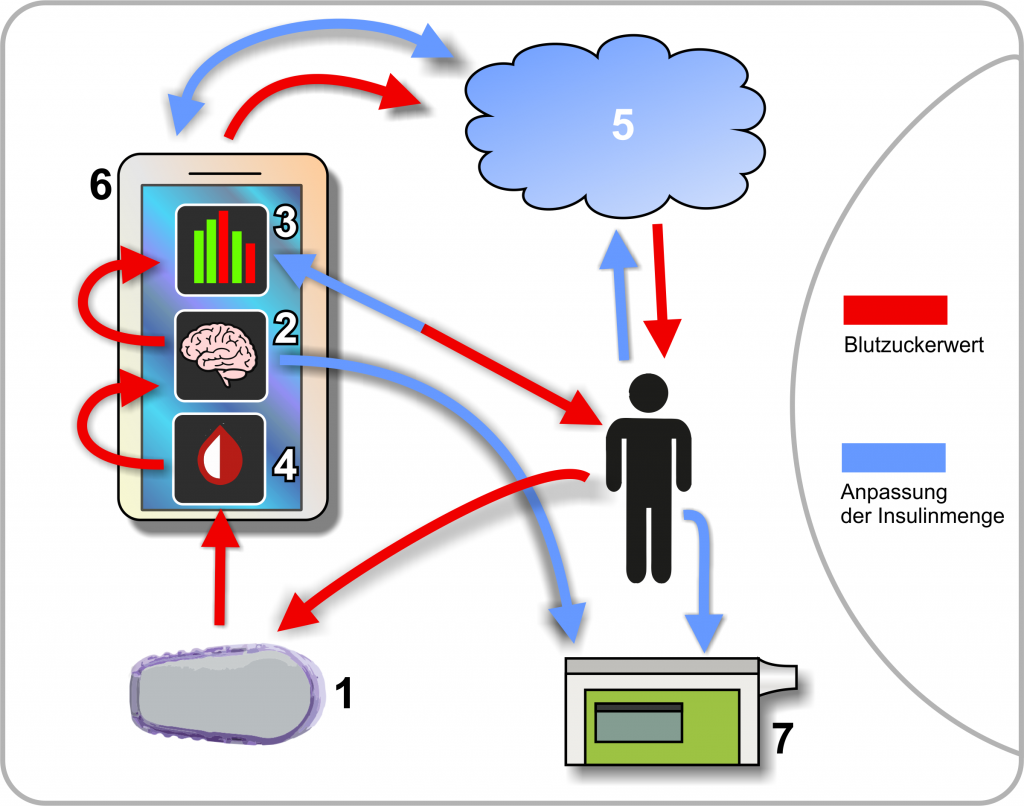 Hybrid Closed loop Marke Eigenbau: Woraus besteht ein Closed Loop System?