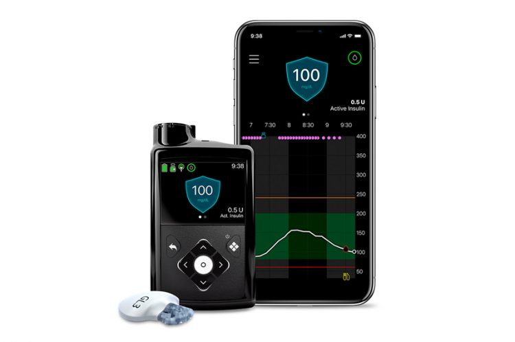 MiniMed 770G Insulinpumpensystem