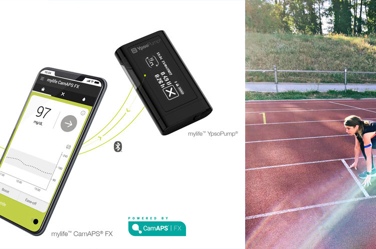 produkttest mylife loop