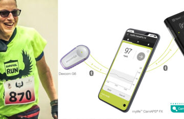 erste erfahrungen mit mylife loop