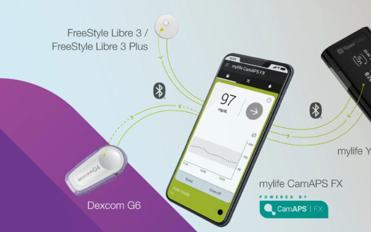 Fully closed loop myeline