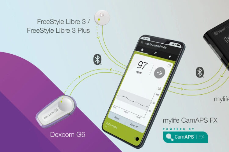 Fully closed loop myeline