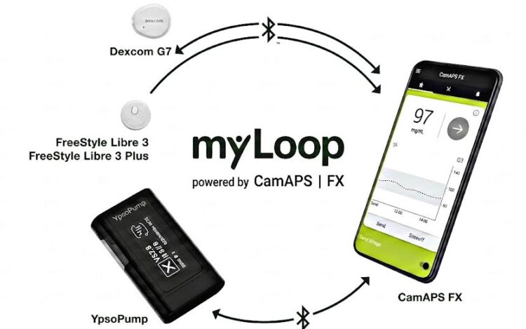Fully closed Loop: my loop